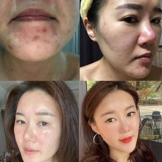 TÌM SỈ CHO MỸ PHẨM HÀN QUỐC INCELLDERM TRÊN TOÀN QUỐC