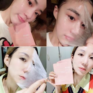 MẶT NẠ TẾ BÀO GỐC NHAU THAI CỪU