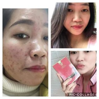Serum ha plus dưỡng da VLIFE hộp màu vàng