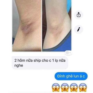 [KEM CÔ BƠ] Chuyên đặc trị hôi nách, thâm nách