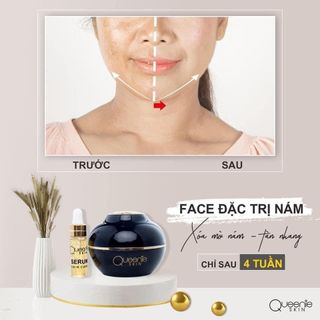 Kem đặc trị Nám Queenie Skin 30gr
