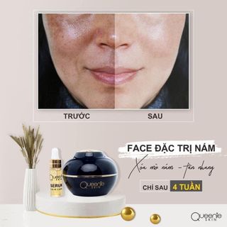 Kem đặc trị Nám Queenie Skin 30gr