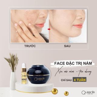 Kem đặc trị Nám Queenie Skin 30gr