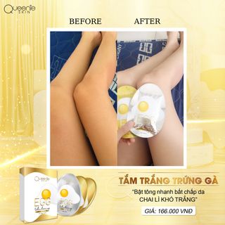 Tắm trắng trứng Queenie Skin 180gr
