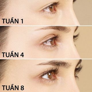 Dài mi, mọc mi Halash