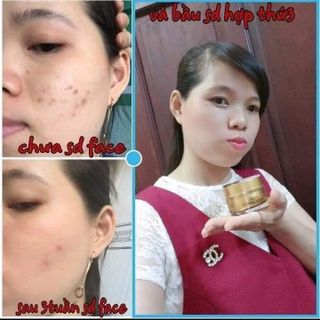 Kem Face Collagen X3 đông anh
