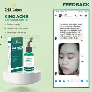 SIÊU PHẨM TRỊ MỤN ĐẦU ĐEN KING_ACNE CHÍNH HÃNG