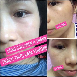 COLLAGEN PEPTIDE DẠNG CỐM MỊN CÁ HỒI NHẬT BẢN PIZKIE