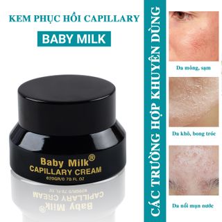 [HOT] Kem Mao Mạch Baby Milk Phục Hồi Da Mỏng Đỏ Nhiễm Corticoid - Hàng Hiệu Cao Thiên Nhi