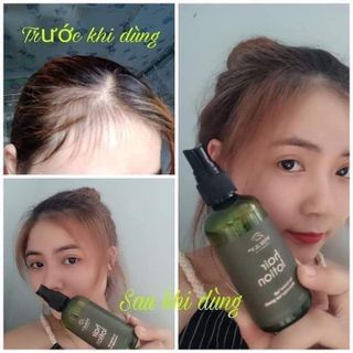 TINH DẦU BƯỞI ( KÍCH MỌC TÓC, TRỊ RUNG)