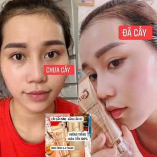 MẶT NẠ CẤY TRẮNG TẢO BIỂN QUIN cho các Spa