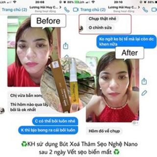 Gel nghệ nano curcumin xóa thâm - làm lành vết thương gấp 40 lần Quin