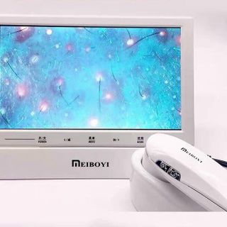 máy soi da cảm ứng