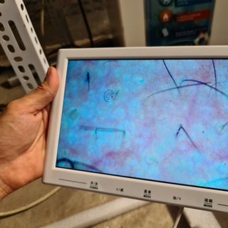 máy soi da cảm ứng