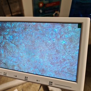 máy soi da cảm ứng