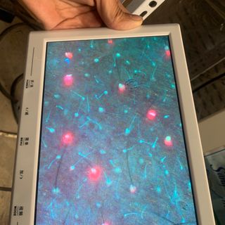 máy soi da cảm ứng