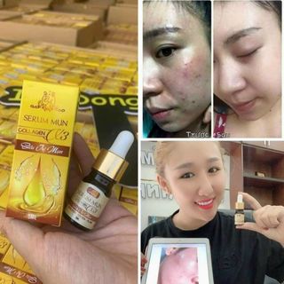 Kem Collagen X3 Luxury Đông Anh chính hãng cty