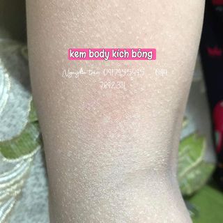 KEM BODY BONG TÁI SINH BODY YODY PHƯƠNG ANH