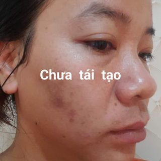 Tinh chất tái tạo da cao cấp Tiên Tiên Dược 50ml