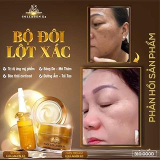 Serum nám đông anh