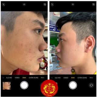 Mộc Linh Chi - Chuyên Trị Mụn Nám Tàn Nhang