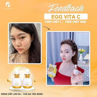 MỶ PHẨM CHÍNH HÃNG QUEENIE SKIN TUYỂN SỈ SERUM TINH CHẤT VITAMIN C