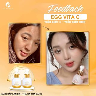 MỶ PHẨM CHÍNH HÃNG QUEENIE SKIN TUYỂN SỈ SERUM TINH CHẤT VITAMIN C