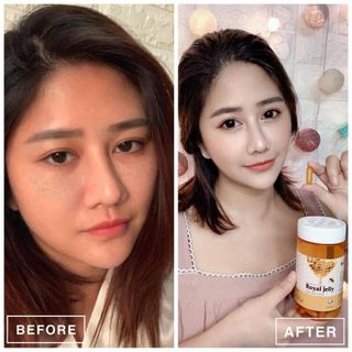 Sữa ong chúa Schon đẹp da, mờ nám tàn nhang, tăng nội tiết chính hãng