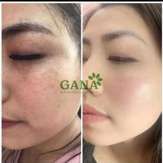 Bena Collagen giá sỉ