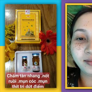 Thuốc chấm tàn nhang,mụn thịt,mụn cóc, đông y gia truyền, xuất sứ lào