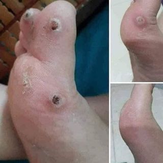 Châm tan nhang đôc quyên gia truyên