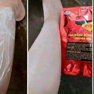 Tắm trắng Hồng sâm