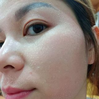 Thuốc chấm tàn nhang đông y gia truyền