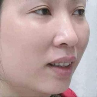 Cao Tái Tạo Da Đông Y( NCCN)