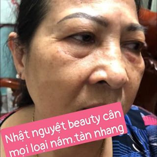 Cao Tái Tạo Da Đông Y( NCCN)