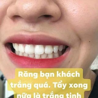 Tổng kho Bút tẩy trắng răng dazzling white
