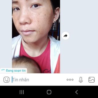 Cao tái tạo da đặt trị mụn thâm nám tàn nhang