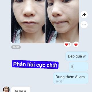 Cao tái tạo da đặt trị mụn thâm nám tàn nhang