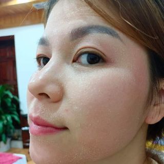 chấm tàn nhang đông y từ lào
