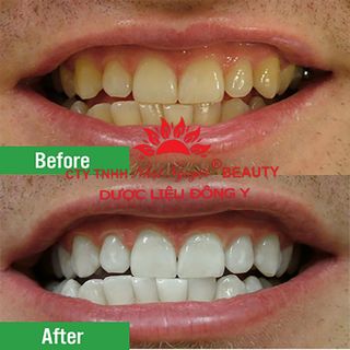 Bút tẩy trắng răng Dazzlingwhite