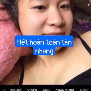 chấm tàng nhang nuốt ruồi đông y ra truyền