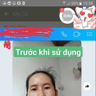 chấm tàng nhang nuốt ruồi đông y ra truyền