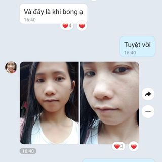 ĐÔNG Y TÁI TẠO DA TRỊ MỤN .NÁM .TÀN NHANG .LÃO HÓA .DA KHÔNG ĐỀU MÀU 100ML