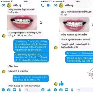 Bút tẩy trắng răng dalling white.trắng cực kì(bán sỉ )