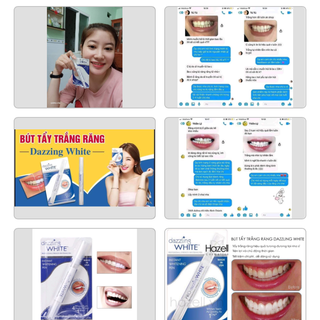 Bút tẩy trắng răng dalling white.trắng cực kì(bán sỉ )