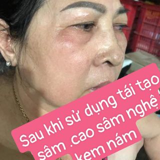 TÁI TẠO DA TRẺ HÓA DA ĐÔNG Y .ĐIỀU TRỊ MỤN .NÁM .TÀN NHANG .TRẺ HÓA DA