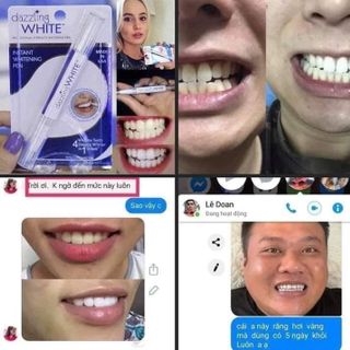 But tay trang rang Dazzing White