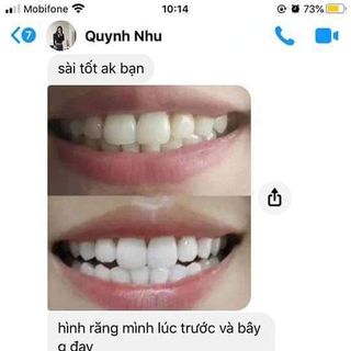 Búp tẩy trắng răng Dazzling white