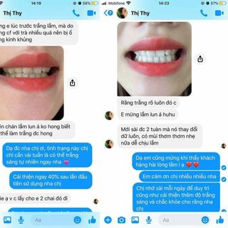 Búp tẩy trắng răng Dazzling white