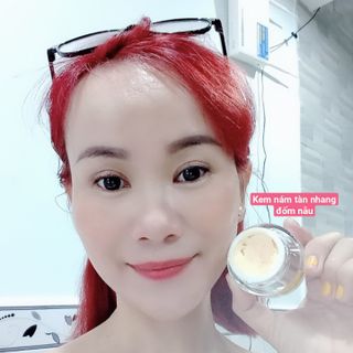 Kem nám , tàn nhang, đốm nâu